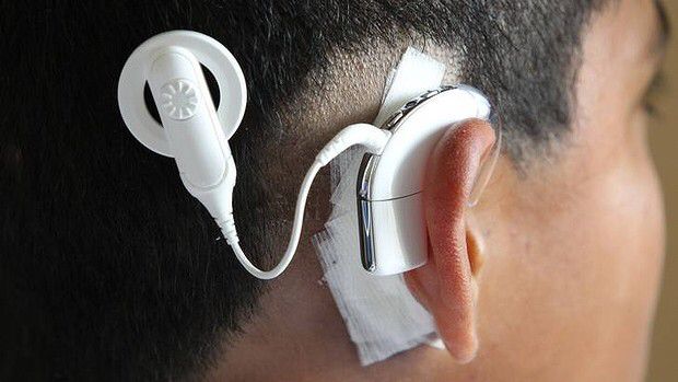 Cochlear Implant Surgeries