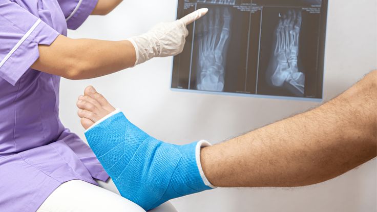 Fractures & Traumas