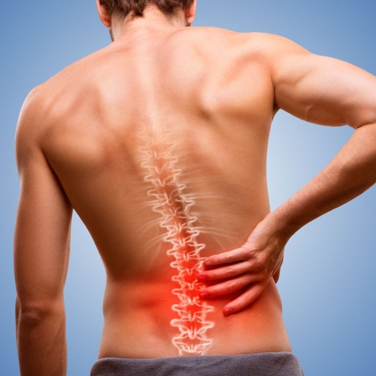Herniated or Slipped Disc