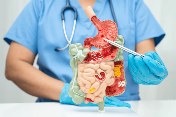 Colon & Intestinal Disorder Treatment