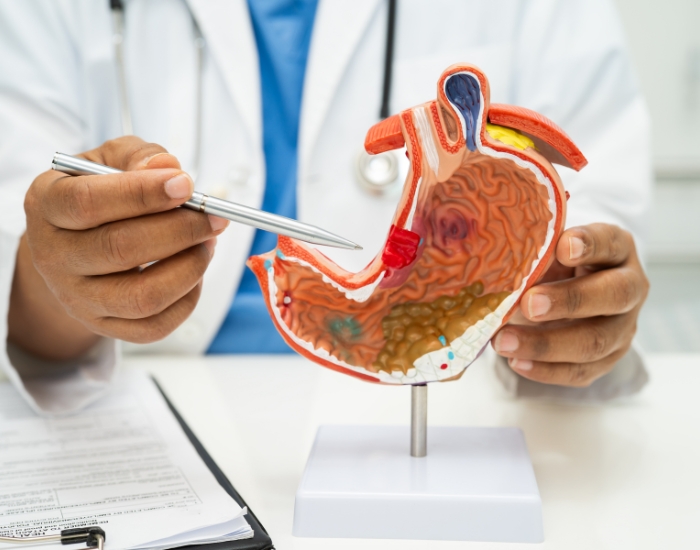 stomach-cancer